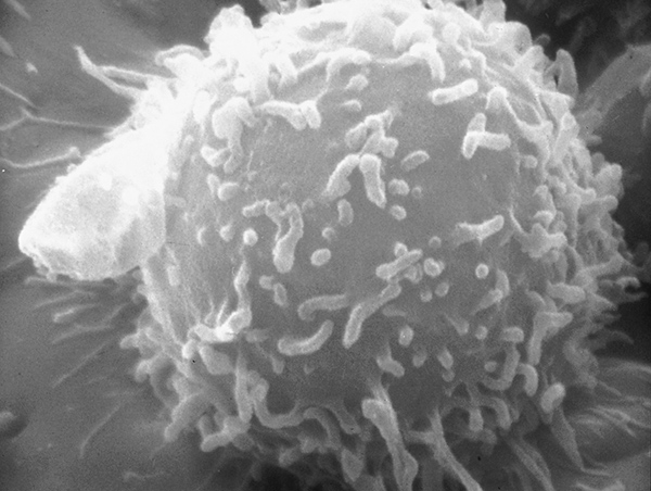Electron microscopic image of a single human lymphocyte. Nivolumab works by releasing the PD-1/PD-L1 brake on cancer-fighting immune cells called T cells, or T lymphocytes.